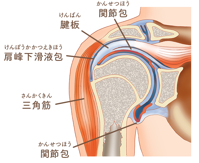 肩関節周囲炎