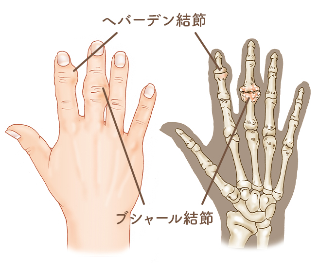 ない 握れ が 手 痛い