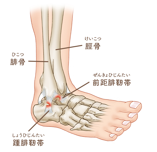 右足 首 が 痛い